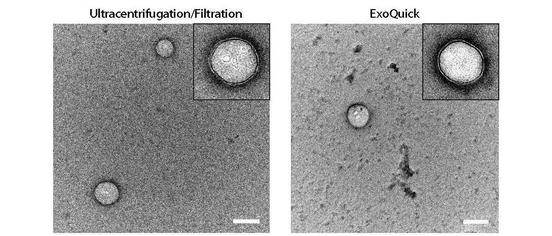 Extracellular vesicles isolated by ultracenrifugation/filtraion versus polymer-assisted precipitation