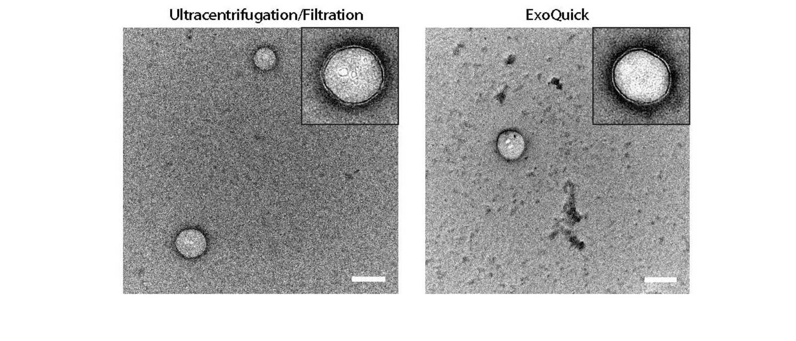 Extracellular vesicles isolated by ultracenrifugation/filtraion versus polymer-assisted precipitation