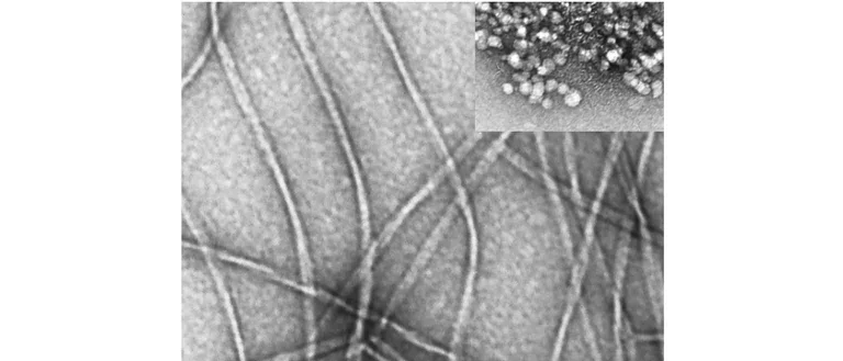 Aβ40 fibrils and oligomers (inset) visualized by electron microscopy.
