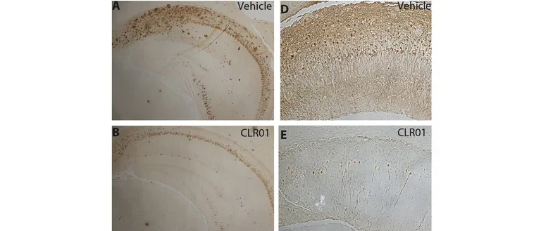 Amyloid plaques and neurofibrillary tangles in a mouse brain before and after treatment with CLR01.