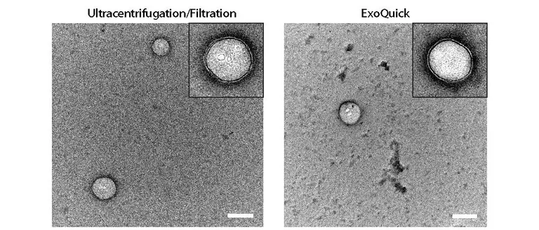 Extracellular vesicles isolated by ultracenrifugation/filtraion versus polymer-assisted precipitation