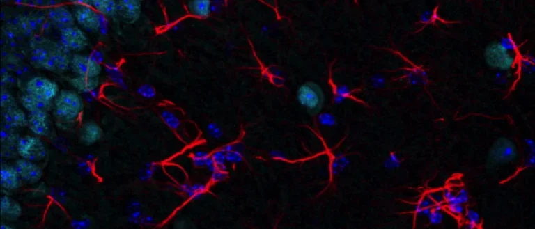 Tauopathy mouse brain