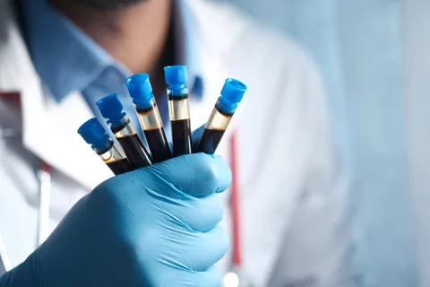 A hand wearing a blue glove holds a vial of blood.