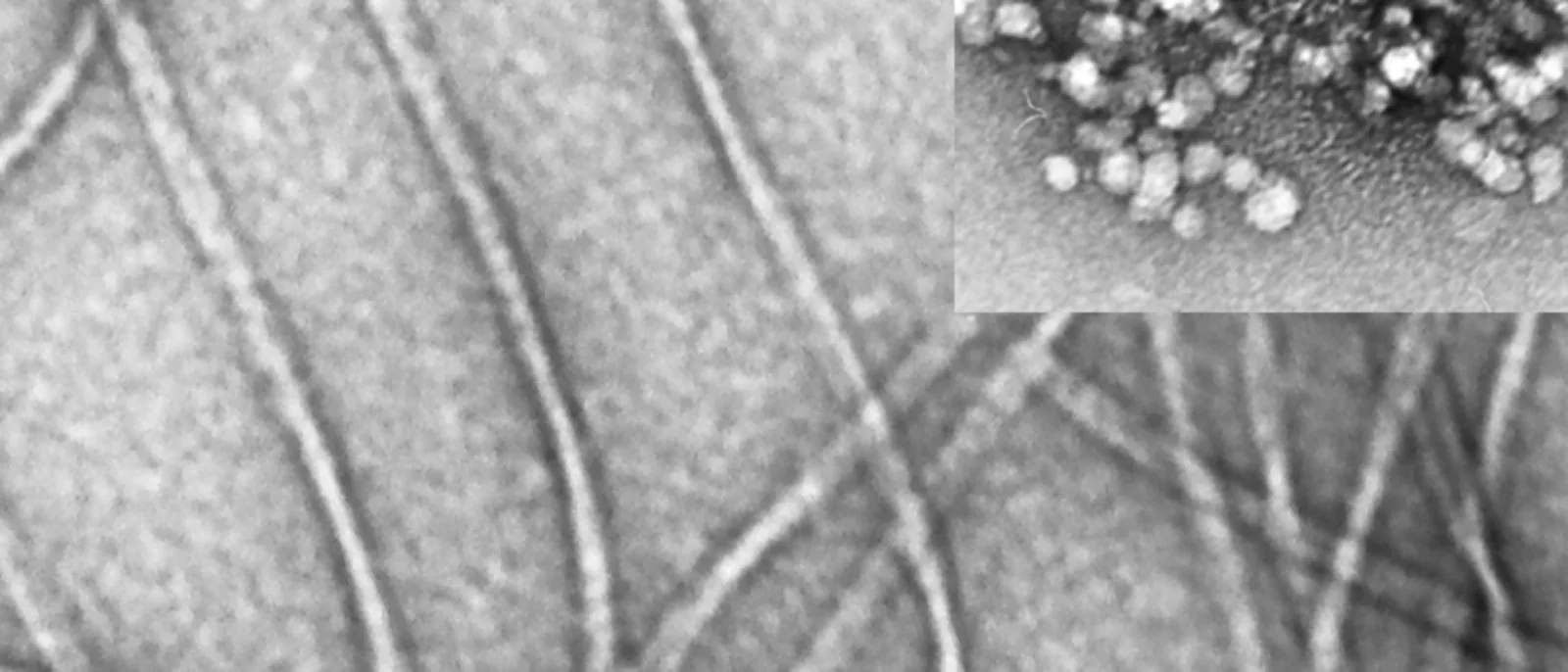 Aβ40 fibrils and oligomers (inset) visualized by electron microscopy.