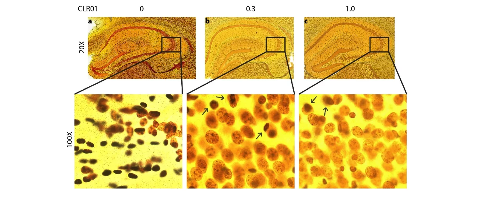 CLR01 reduces tau aggregates (Gallyas silver-stain) in a tauopathy mouse model.