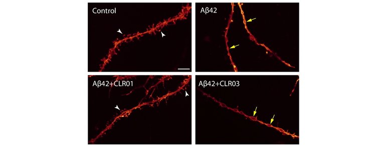 Dendritic spines depleted by Aβ42 and rescued by CLR01.