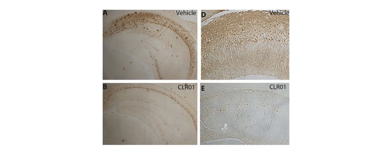 Amyloid plaques and neurofibrillary tangles in a mouse brain before and after treatment with CLR01.