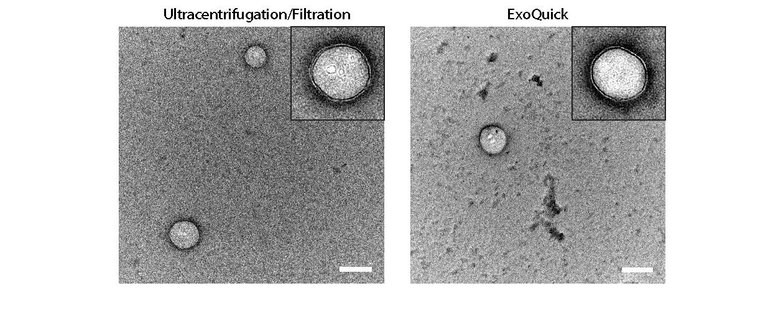 Extracellular vesicles isolated by ultracenrifugation/filtraion versus polymer-assisted precipitation.